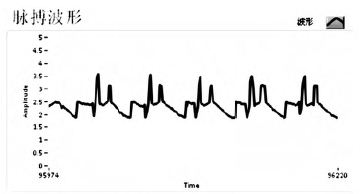 图9干扰后的心率图形在测试过程中也发现,心率脉搏有部分受到干扰,受