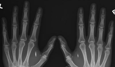 追踪芯片-身份证的芯片可追踪,宠物追踪芯片,手