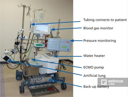 信息源:dellchildrensecmo 的本质是一种改良的人工心肺机,核心的部分